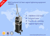 40w Co2 Thiết bị Laser Phân đoạn / Thiết bị thắt chặt âm đạo thương mại