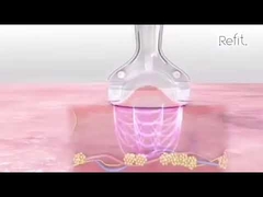 MLS05 Portable 40K Cavitation Chân không siêu âm Cellulite Thiết bị giảm Cellulite