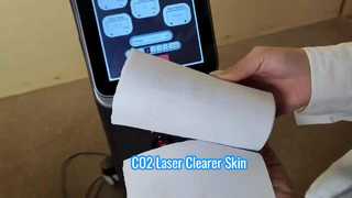 60W 7 Scan Shapes Trẻ hóa da Loại bỏ mụn Máy Laser Co2 Fractional
