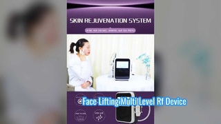 Chăm sóc mắt 60W không xâm lấn Thiết bị tần số vô tuyến mịn màng đa cấp