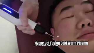Ozone Jet Fusion Máy plasma lạnh và ấm để làm chặt da và loại bỏ nếp nhăn