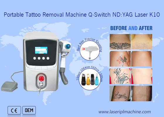 Sgs 1064nm 532nm Máy loại bỏ hình xăm bằng laser để loại bỏ nháy mắt