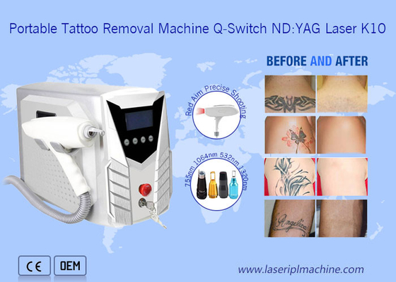 Máy loại bỏ hình xăm bằng laser 1064nm 532nm Động tay với tay cầm có thể tháo rời
