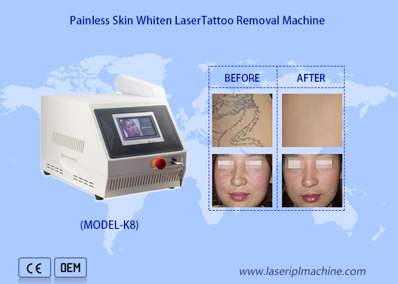 1320nm 1064nm 532nm Máy làm trắng da bằng laser Nd Yag