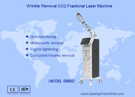 Máy laser CO2 phân đoạn dọc loại bỏ sắc tố loại bỏ sẹo