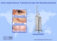 RF Fractional CO2 Laser For Stretch Marks Scar Removal Máy thắt kín âm đạo