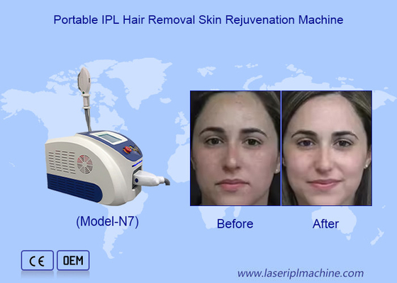 IPL nâng cao loại bỏ lông bằng laser và trẻ hóa da với tinh thể ánh sáng sapphire nhập khẩu