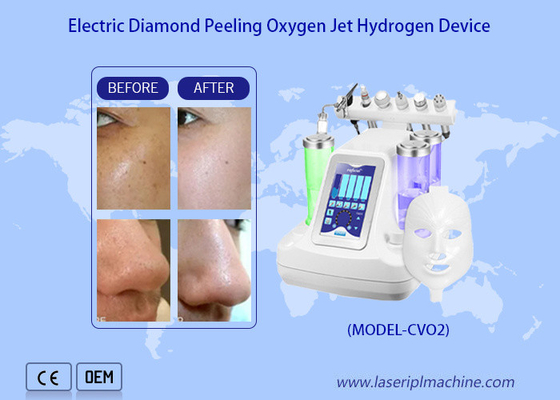 Mặt sạch sâu nước oxy máy peel máy / hydro Dermabrasion nước oxy máy lọc sâu da