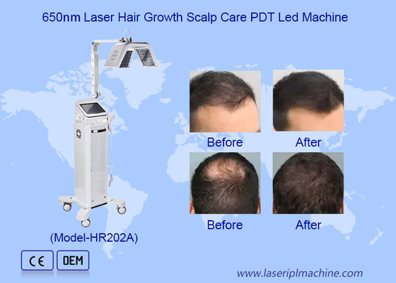 Máy kích thích tăng trưởng tóc tần số cao an toàn Máy liệu pháp laser