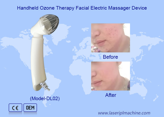 Thiết bị xoa bóp mặt bằng điện Ozone Therapy cầm tay để loại bỏ mụn nhăn