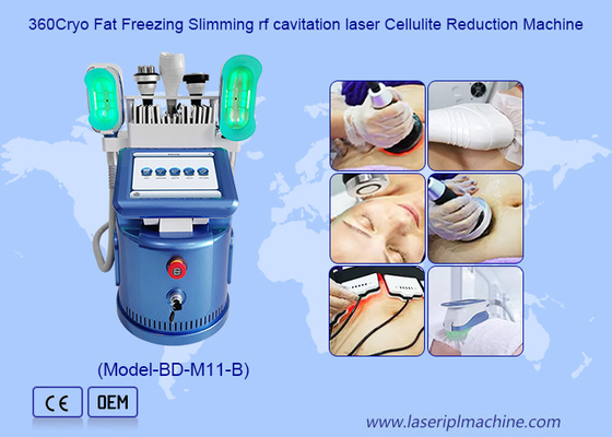 360 Cryo Vacuum RF Lipo Laser 6 In 1 Fat Freezing Máy giảm cân cơ thể