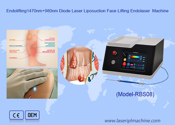 1470nm 980nm Diode Laser Bệnh trĩ Điều trị hút mỡ Máy giảm cân cơ thể