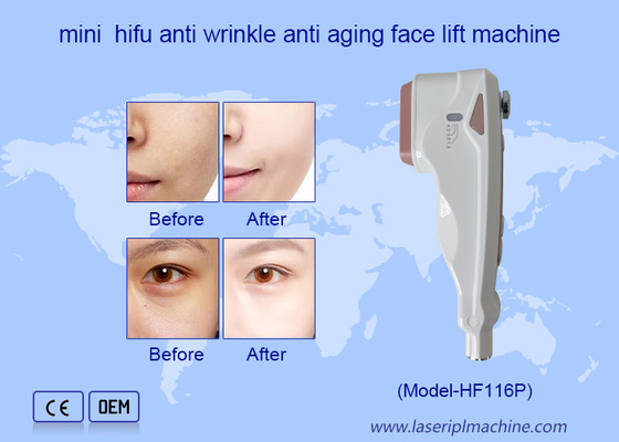Sử dụng tại nhà HIFU Chăm sóc khuôn mặt Loại bỏ nếp nhăn Da trẻ hóa Máy nâng mặt