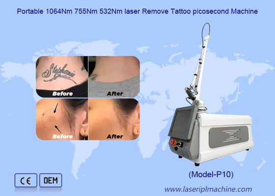 Máy làm trắng da di động Tải hình xăm Picosecond Nd Yag Laser