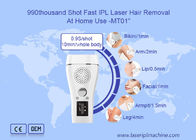 990 Ngàn bắn nhanh Ipl Beauty Machine Laser Triệt lông vĩnh viễn