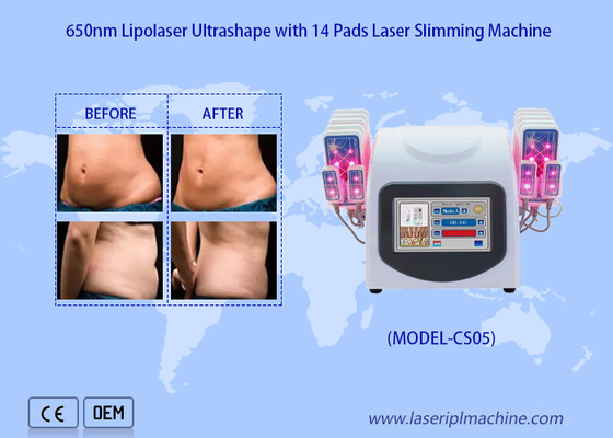 Máy hút mỡ bằng Laser Lipo 650nm để giảm mỡ Cellulite