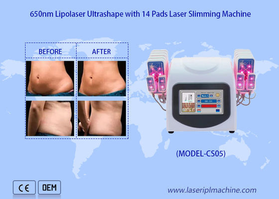 Giá tốt. Máy hút mỡ bằng Laser Lipo 650nm để giảm mỡ Cellulite trực tuyến