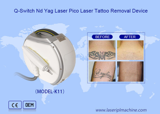 Máy laser Nd Yag 1064nm để loại bỏ hình xăm bằng laser carbon