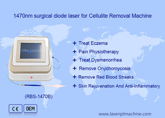 Giá tốt. 1470nm 980nm Diode Laser Lipolysis Phẫu thuật Thiết bị laser dung dịch chất béo trực tuyến